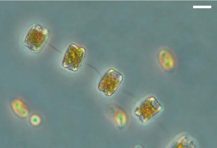 Shifts in Phytoplankton Diversity with Relation to Temperature and Salinity along the Western Antarctic Peninsula